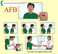 Phương pháp xét nghiệm đờm AFB chuẩn đoán chính xác bệnh lao phổi