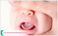 Đa khoa Hoàn Cầu phân tích em bé bị viêm họng nên làm gì?