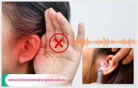 Khám nội soi tai ở đâu? có đau không?
