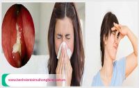 [TP.HCM] Nguyên nhân gây lỗ mũi có mùi hôi và giải pháp chữa trị