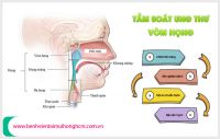 Tầm soát ung thư vòm họng là gì