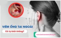 Viêm tai ngoài có tự khỏi không? Điều trị như thế nào hiệu quả?