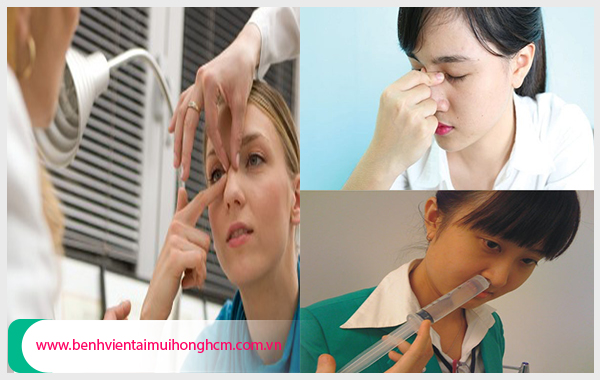 Cần chữa xoang mũi bằng phương pháp hiện đại