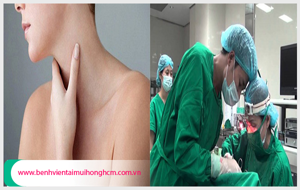 Cần điều trị polyp thanh quản ở địa chỉ uy tín