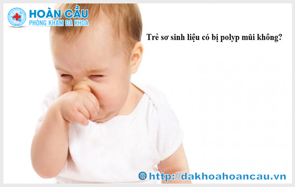 Trẻ sơ sinh vẫn có nguy cơ bị bệnh polyp mũi